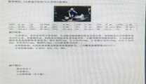 50岁大叔心包积液，单孔胸腔镜微创手术有效救治