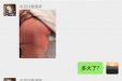关注儿童过敏 实现预防治疗康复全周期管理   