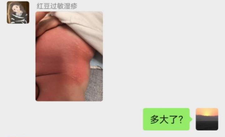 关注儿童过敏 实现预防治疗康复全周期管理   